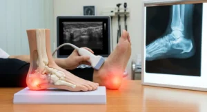 Badanie USG stopy, model anatomiczny i zdjęcie RTG stopy z wyraźnie widoczną ostrogą piętową.